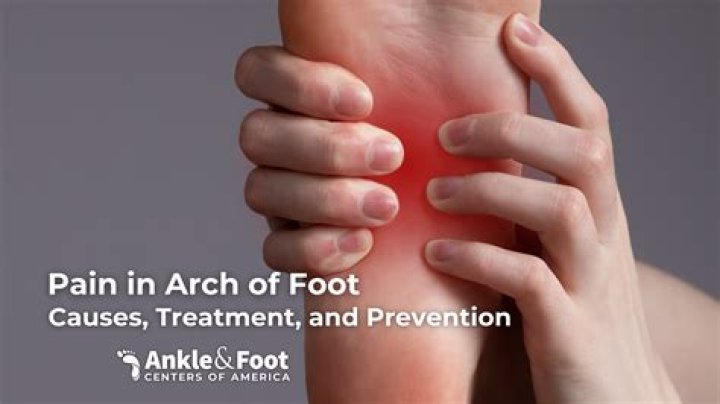 Are Fallen Arches painful