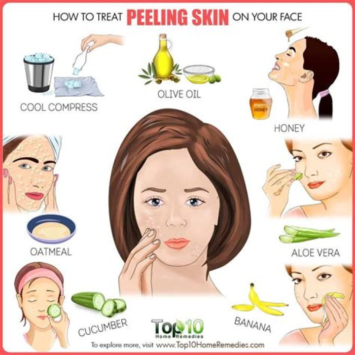 Are peelings good for your face