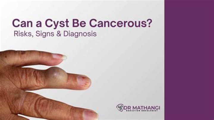 Can a jaw cyst be cancerous