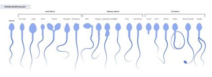 Can a man sell sperm