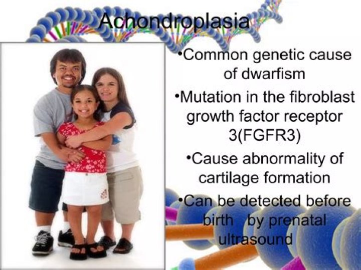 Can achondroplasia be cured