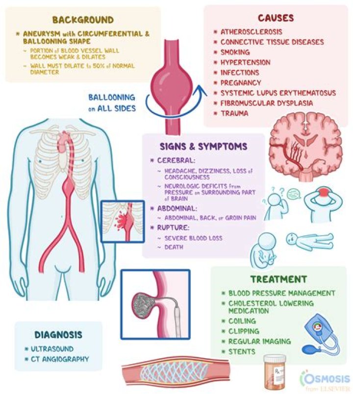Can ALS be caused by trauma