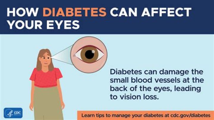 Can anastrozole cause eye problems