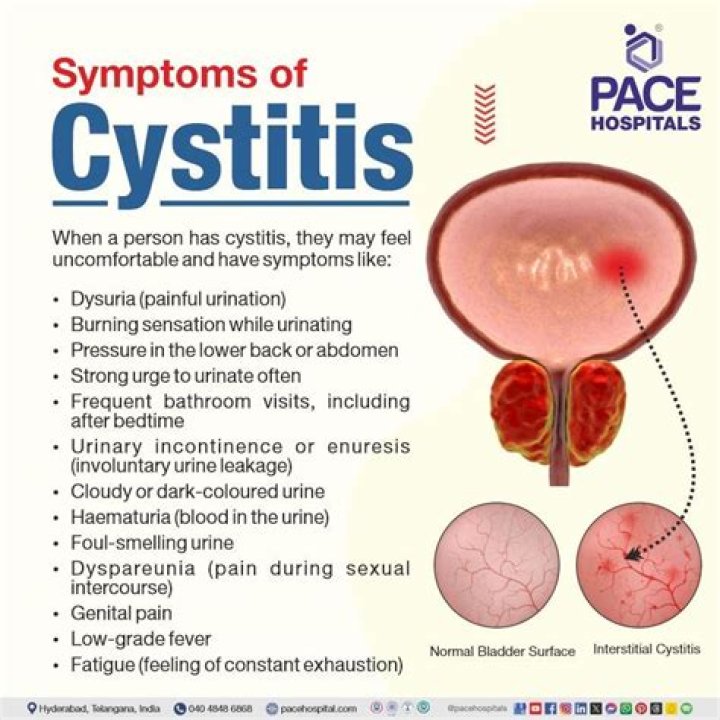 Can cystitis last for weeks