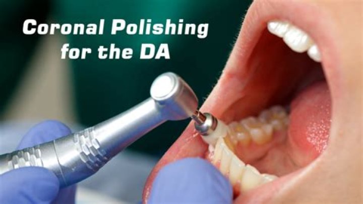 Can dental assistants coronal polish