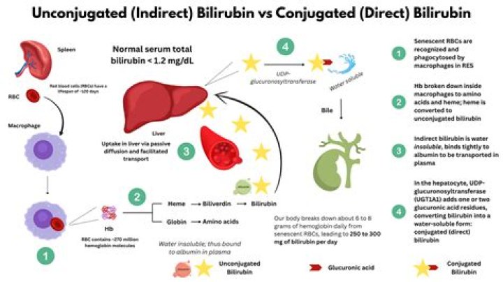 Can high bilirubin cause brain damage in adults