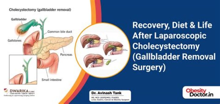 Can I eat olive oil after gallbladder removal
