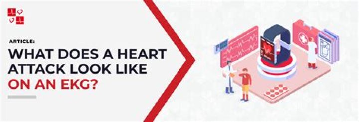 Can I take naproxen after a heart attack