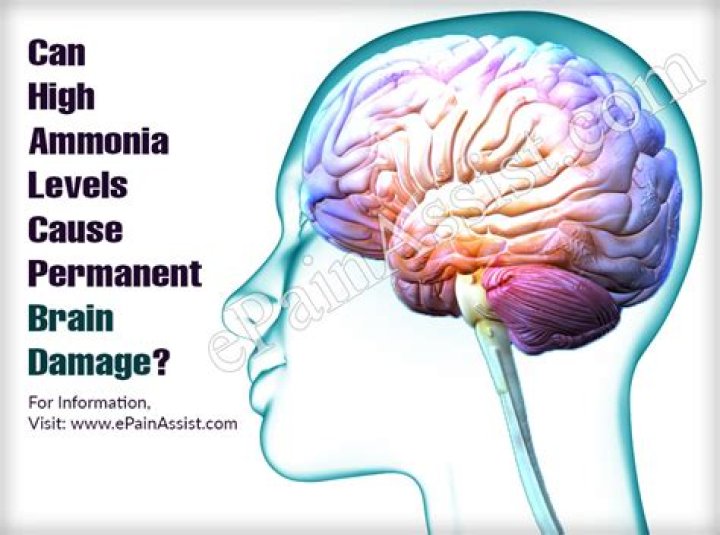 Can low sodium levels cause permanent brain damage