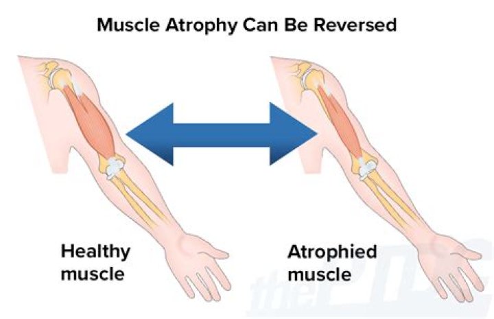Can muscle shortening be reversed