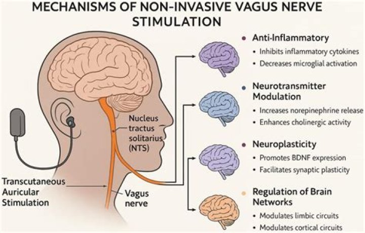 Can vagus nerve cause sweating