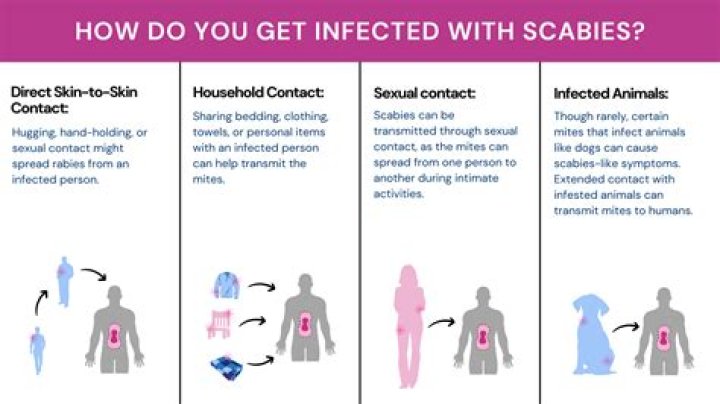 Can you be misdiagnosed with scabies