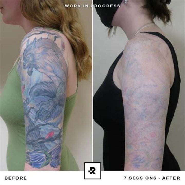 Can you put black over a color tattoo