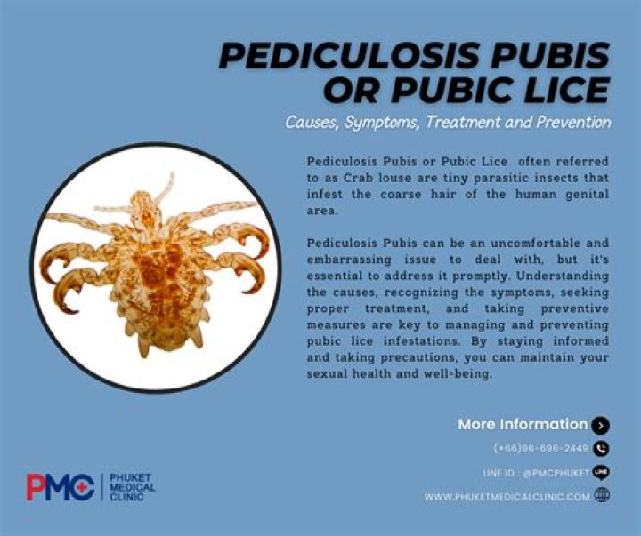 Can you use head lice treatment on pubic lice