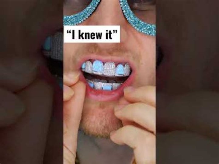 Can you wear fake Grillz with braces