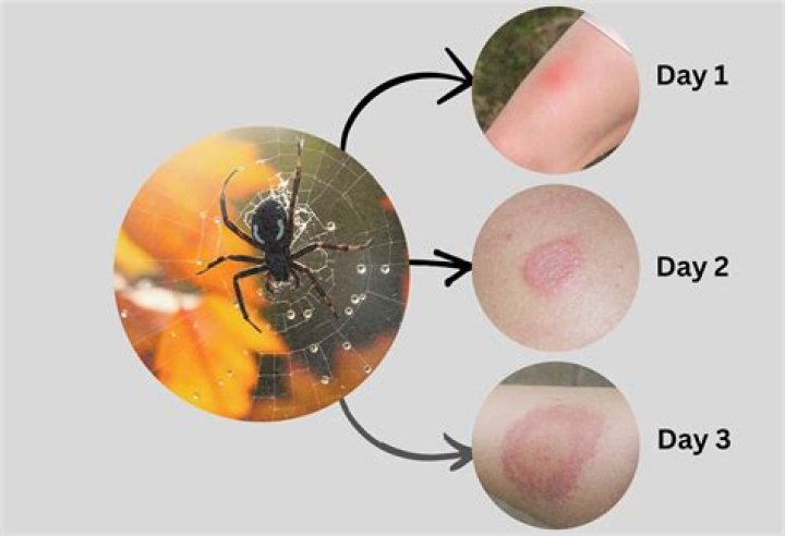 Do common household spiders bite