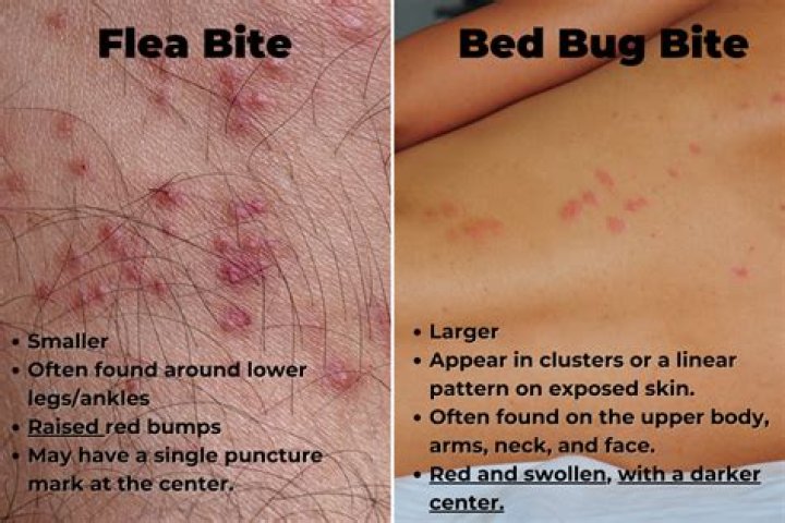 Do fleas bite in clusters