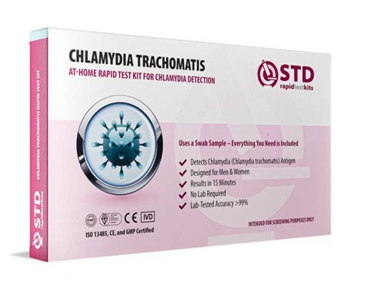 Do I have chlamydia test