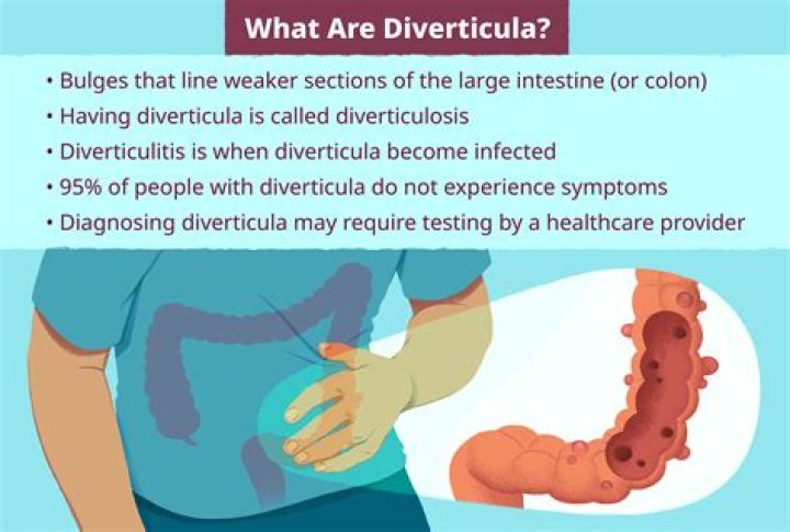 Does diverticulitis show in urine