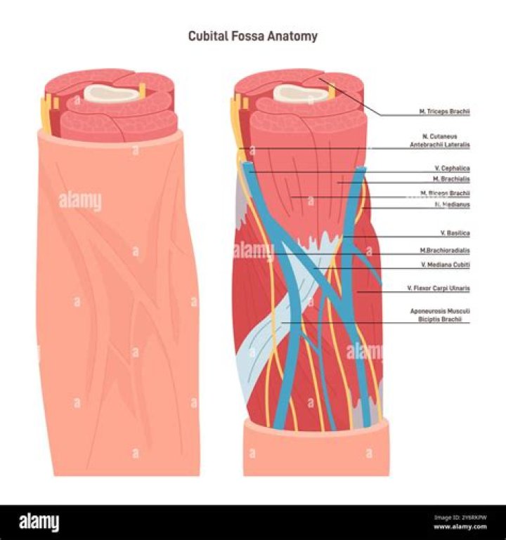 Does the radial nerve go through the cubital fossa