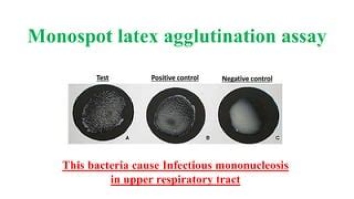 How accurate is a Monospot test
