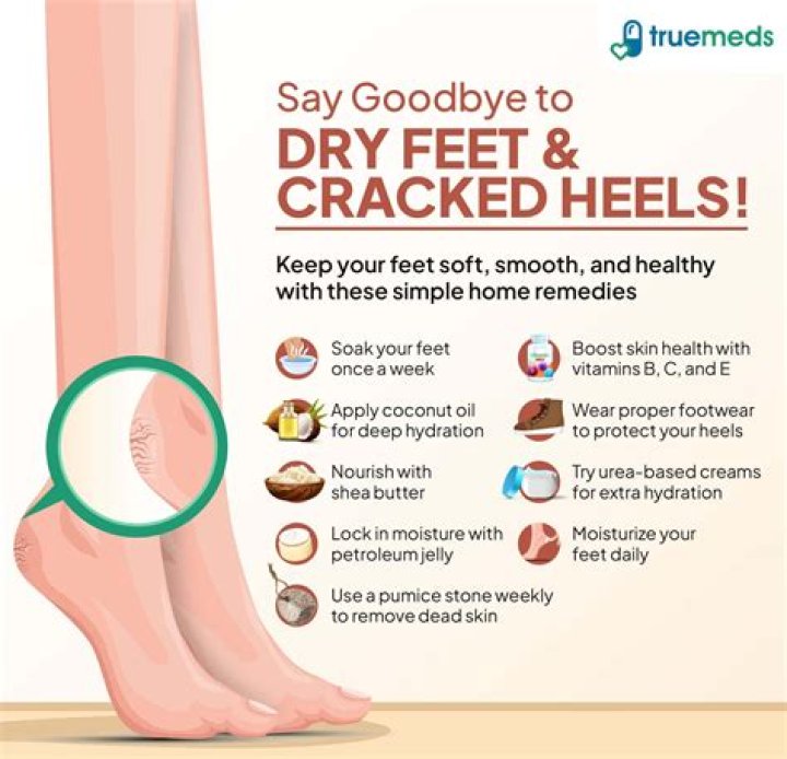 How can I soften my cracked feet at home