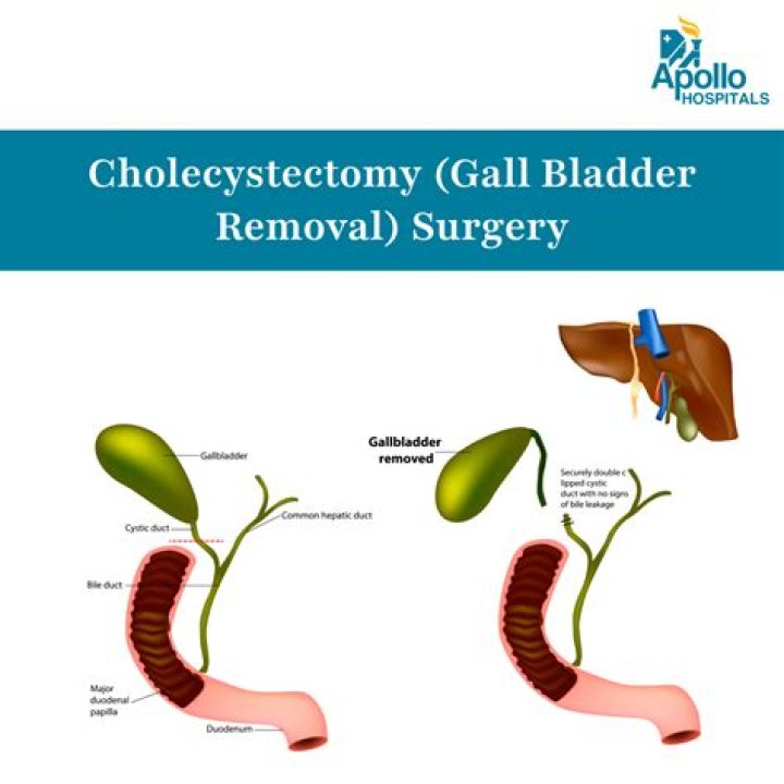 How can I stop my gallbladder from itching