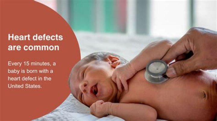How common are heart defects in babies