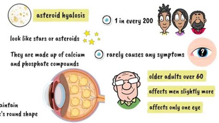 How common is asteroid Hyalosis