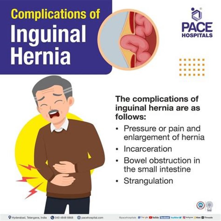 How common is hernia in kids