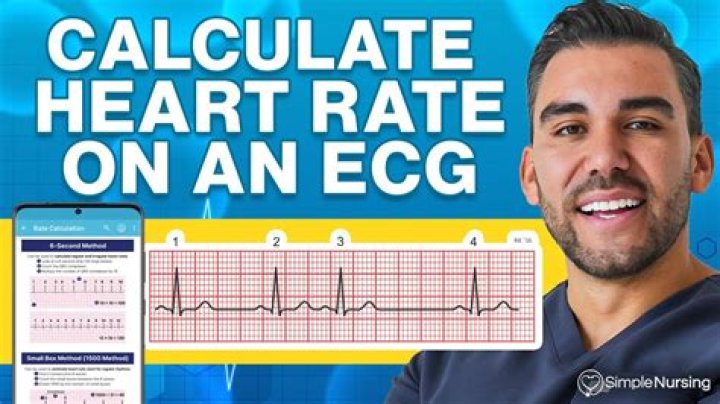 How do you calculate heart rate on an irregular ECG
