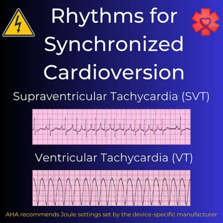 How do you Cardiovert on ACLS