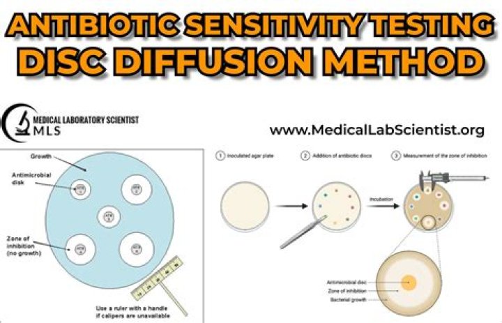 How do you do disc diffusion method