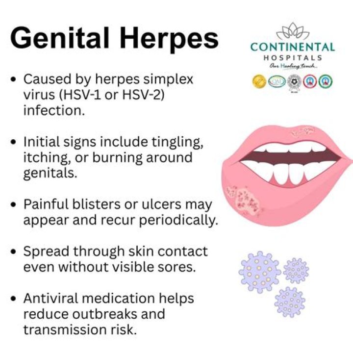 How do you get a herpes virus