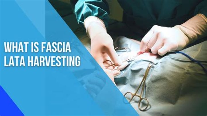 How do you harvest fascia lata