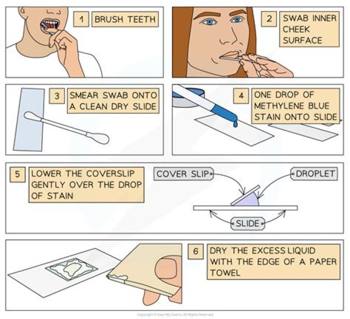 How do you identify a cheek cell