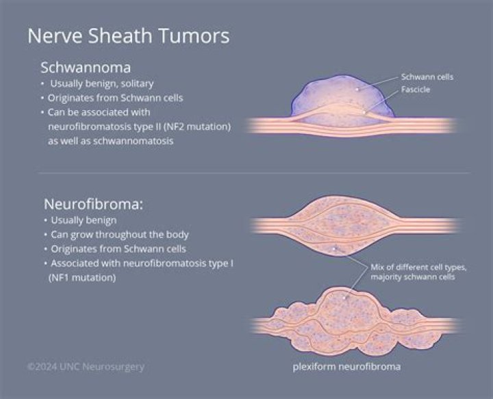 How do you stop neurofibromas from growing
