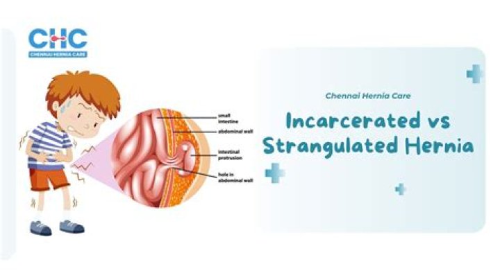 How do you treat an incarcerated hernia