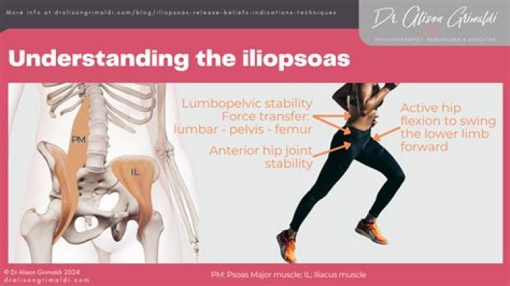 How do you treat Iliacus pain