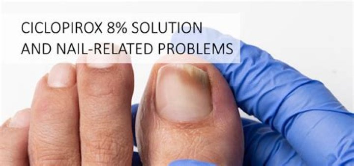 How do you use ciclopirox Olamine cream for toenail fungus