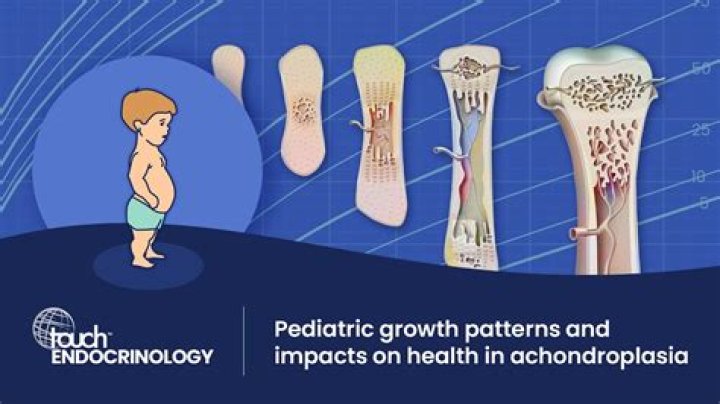 How does achondroplasia affect the body