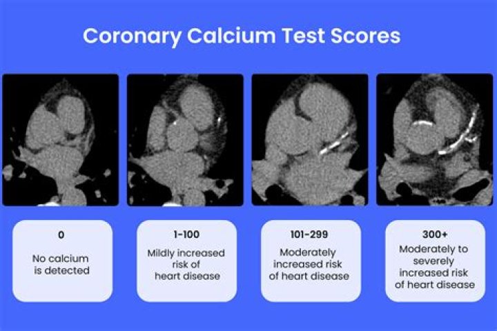 How does low calcium levels affect the heart