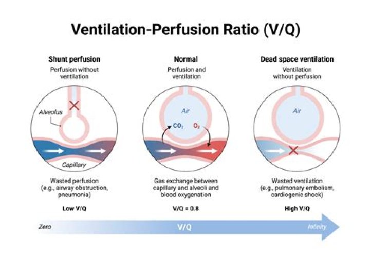 How does pressure affect ventilation