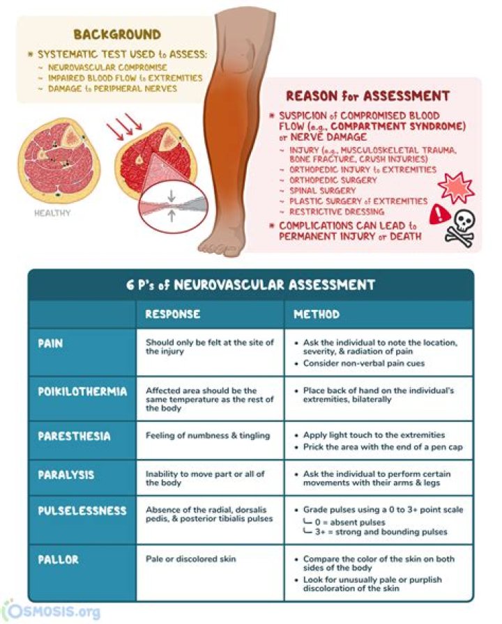 How frequent is a neurovascular assessment needed