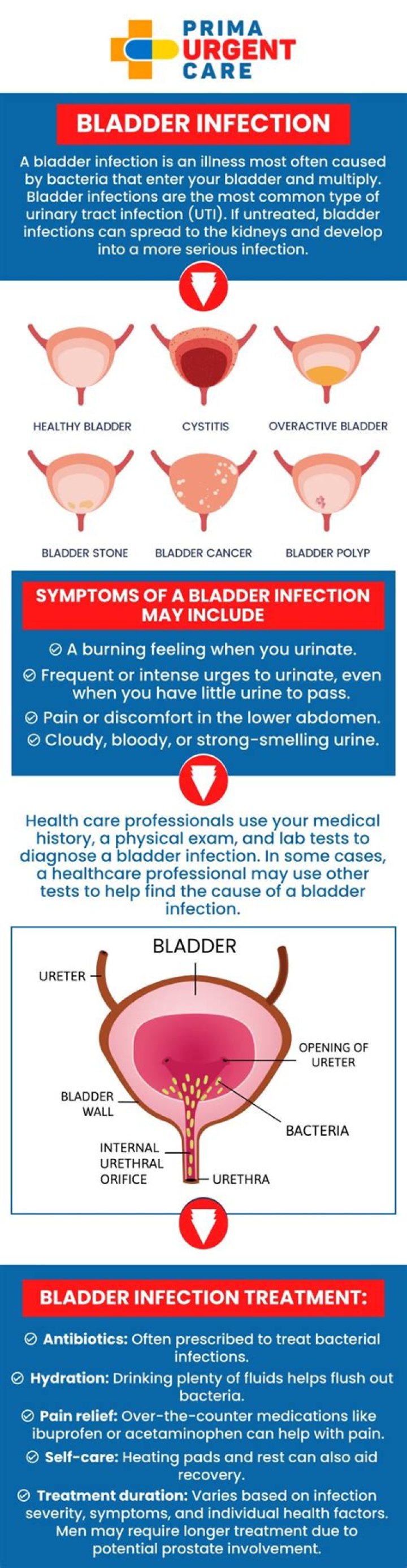 How is a bladder infection diagnosed