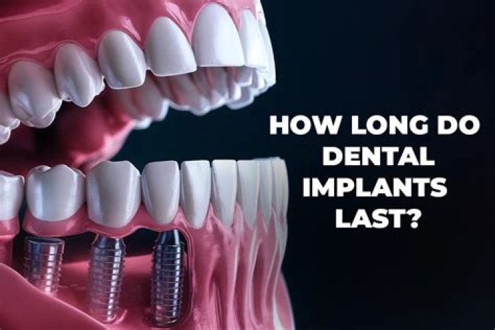 How long do Mentor gel implants last