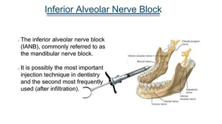 How long does a dental nerve block take to wear off