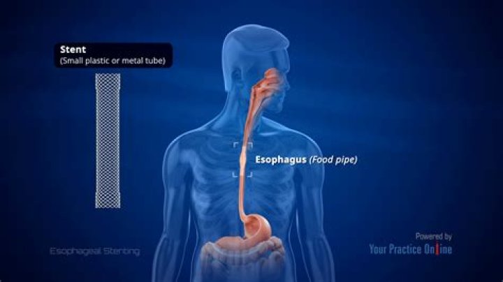 How long does an Esophagram take