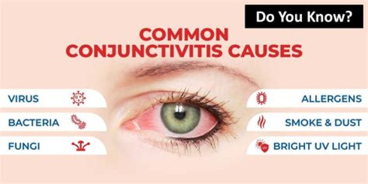 How long does conjunctivitis last for