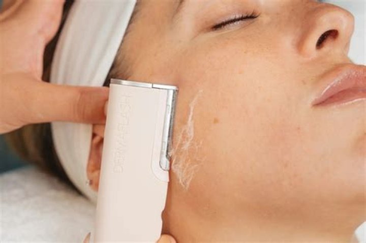 How long does Dermaflash last